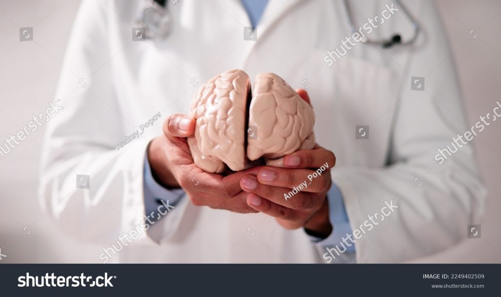 medcare vacances - stock photo doctor holding cognitive rehabilitation dementia and psychology model 2249402509